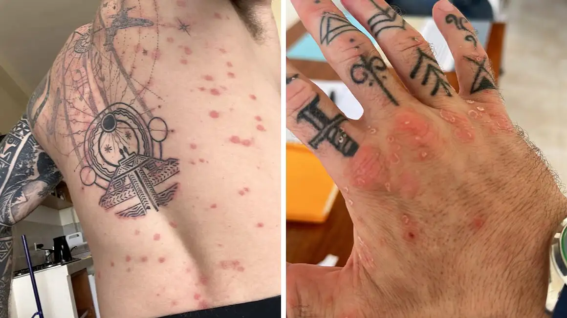 Plaies au dos et aux mains sur le corps du tatouage.