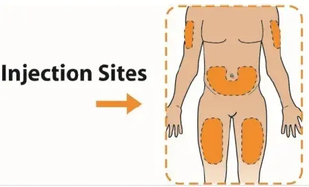 Twist the clear cartridge several times in the direction of the arrow - Illustration