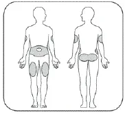 Insert the needle into your skin - Illustration