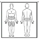 Continue to hold the Dose Knob in and slowly count to 5 before removing the Needle - Illustration
