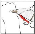 Apply to the affected area - Illustration