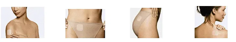 Patch application sites - Illustration