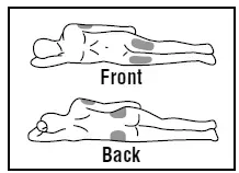 Choose the injection site - Illustration