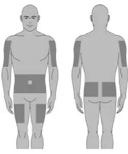 Select location of infusion sites - Illustration