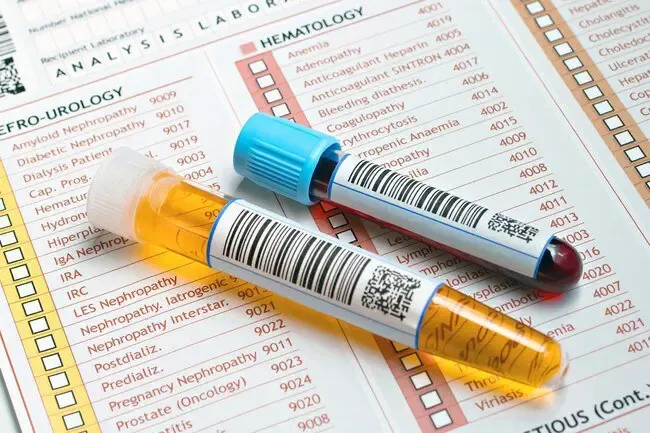 Conditions qui peuvent provoquer du sang dans votre urine