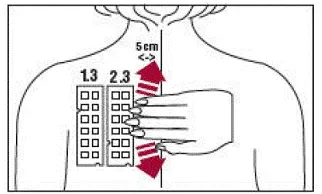 Position test Panel 2.3 on the patient’s back - Illustration