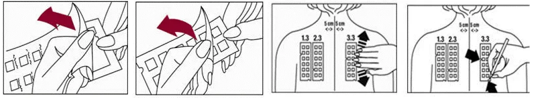T.R.U.E. Test panels - Illustration