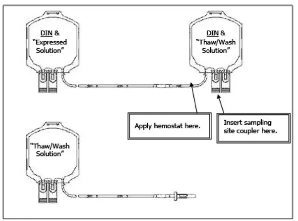 Transfer Set Diagram - Illustration