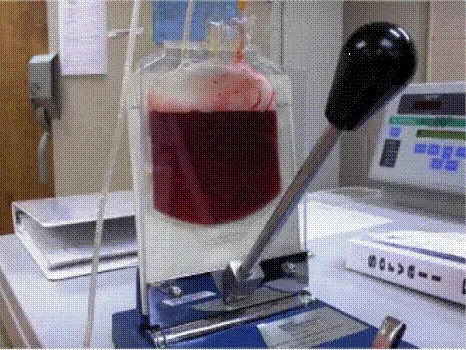 Place transfer bag labeled DIN and Thaw/Wash Solution into a plasma extractor - Illustration