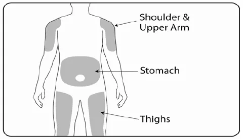 Application areas - Illustration