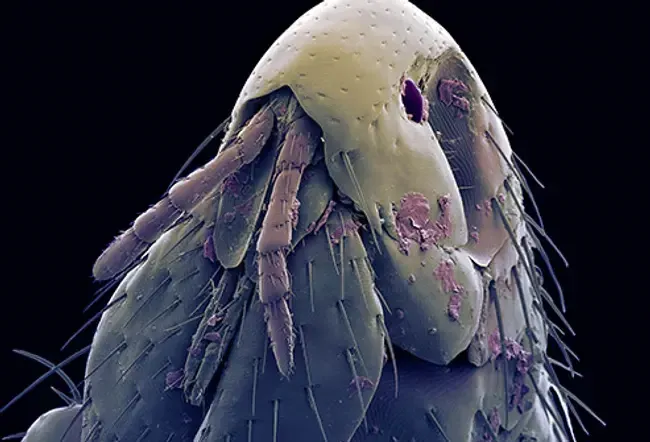 Santé pour animaux de compagnie et vous: maladies que vous pouvez obtenir de vos animaux de compagnie