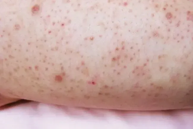 Condizioni della pelle: cose che sembrano spaventose ma non sono