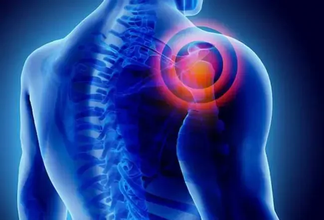 It is pain and stiffness in your shoulder that happens slowly.