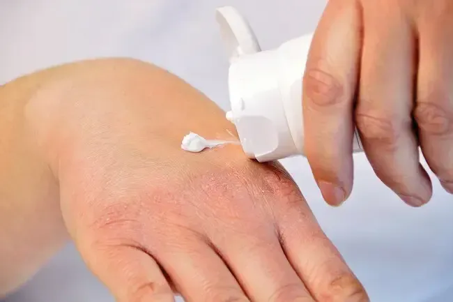 Salute delle donne: consigli per affrontare la secchezza