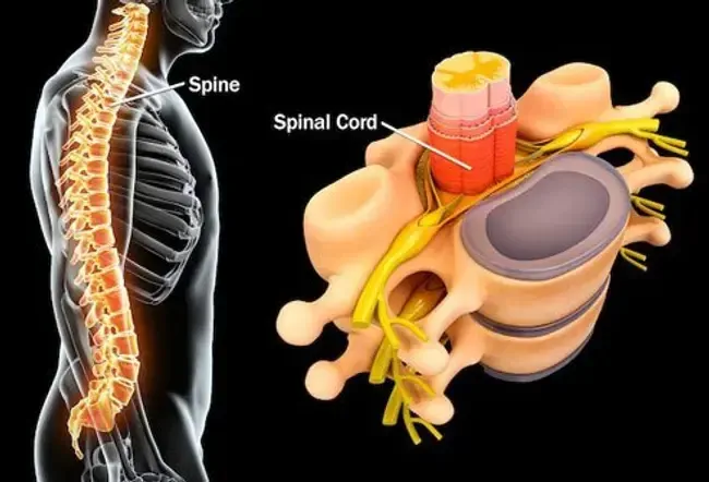 Rückenschmerzen: Häufige Wirbelsäulenprobleme