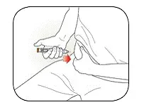 Insert the Needle into your skin - Illustration