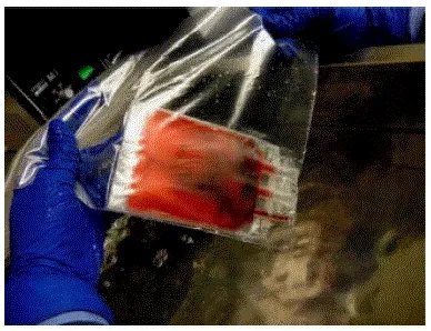 The contents of the cryobag become slushy remove the bag from the 37°C water bath - Illustration