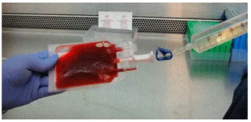 Slowly introduce approximately half the volume of the reconstitution solution to the thawed product while mixing the fluids in the bag - Illustration