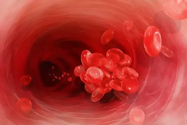 Fibrillazione atriale: come trattare la fibrillazione atriale (AFIB)