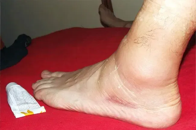 Ihre Gesundheit: So lagern Sie Ihren Natural Medicine -Schrank aus