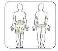 Choose your injection site - Illustration