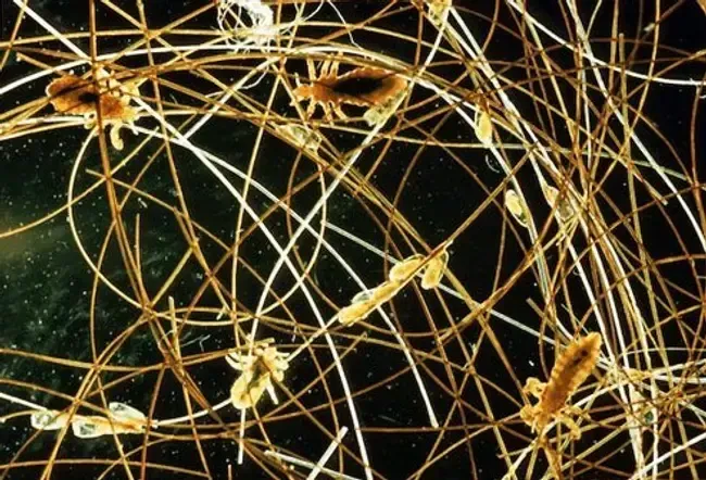 Hautgesundheit: Die Kreaturen, die auf Ihrem Körper leben