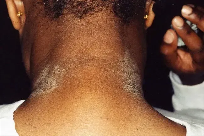 Problemi e trattamenti della pelle: cause delle lesioni cutanee