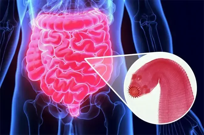 Tapeworms are gut parasites that can invade the digestive tract of humans.