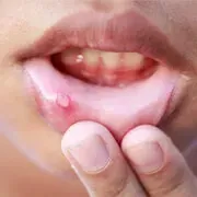 Image Collection Home - RxList