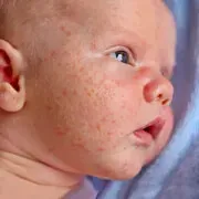 Image Collection Home - RxList