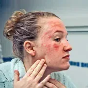 Image Collection Home - RxList