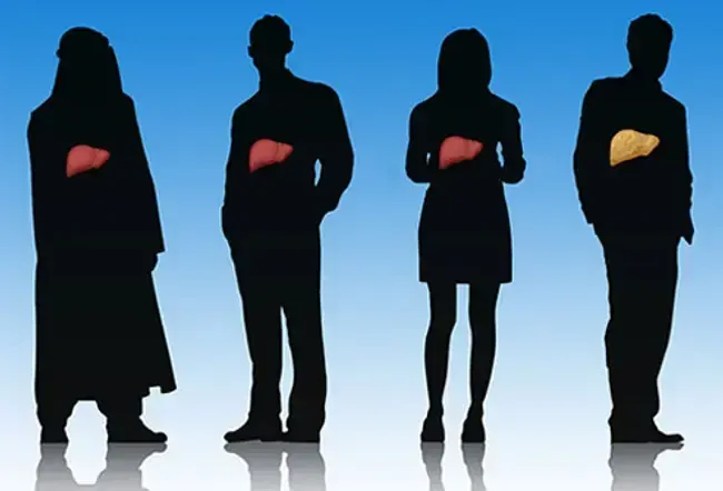 Mitdní onemocnění jater: nealkoholické, alkoholické symptomy a léčba