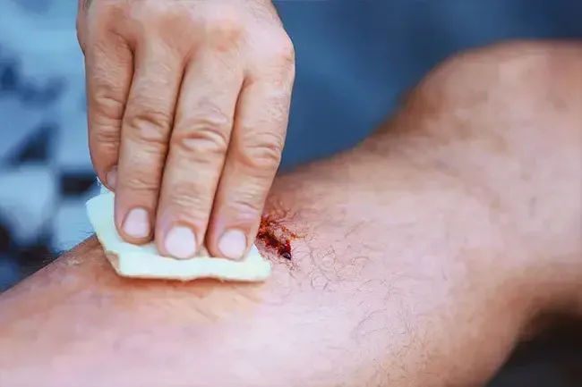 Médicaments et médicaments: utilisation de la santé du peroxyde d'hydrogène